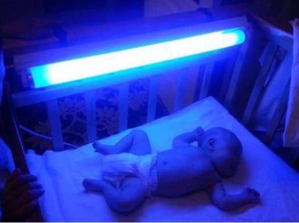 Аренда лампы для фототерапии. Лечение желтухи у малышей! в фото 4