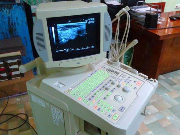 ALOKA Алока 1400 аппарат сканер УЗИ ультразвуковой диагностики в Краснодаре фото 9