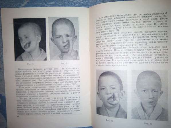 Пластические операции на лице 1953г в Чите фото 3