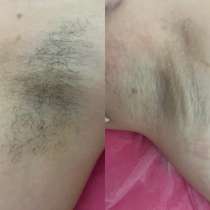 Шугаринг, в Уфе